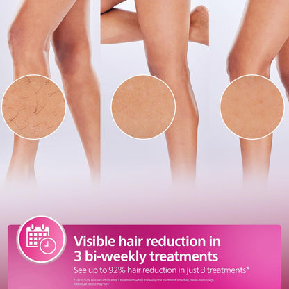 Philips Lumea IPL Hair Removal – Smooth, Salon Results at Home